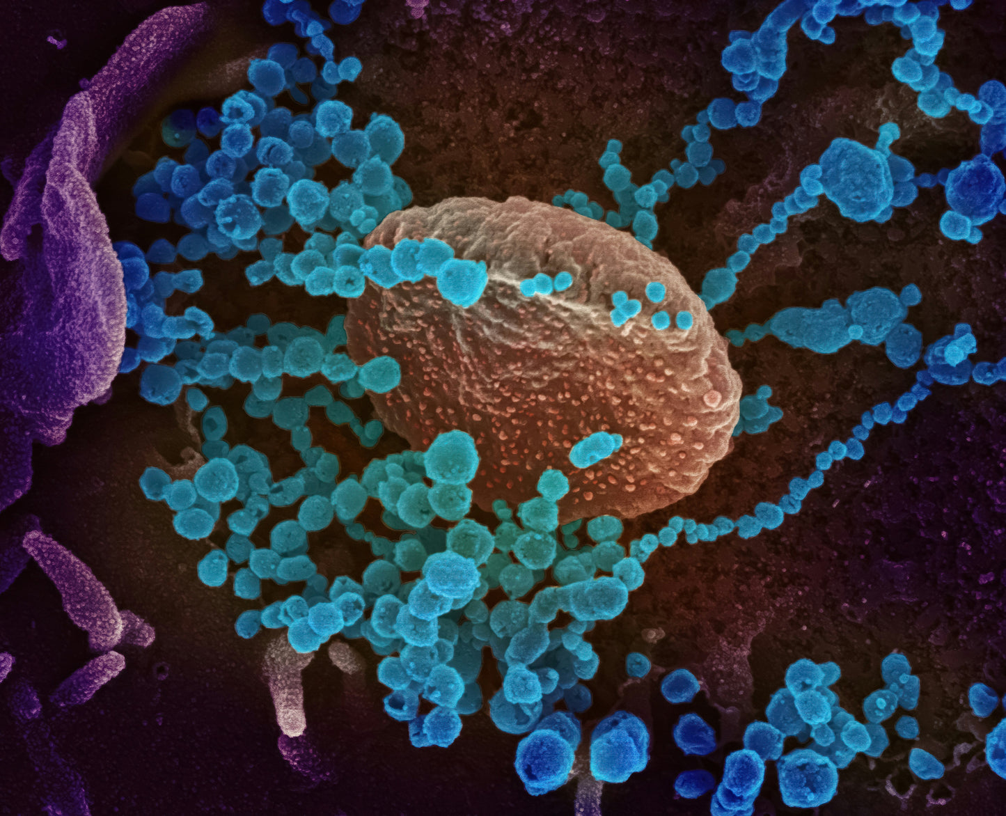 Toxoplasma IgG and IgM