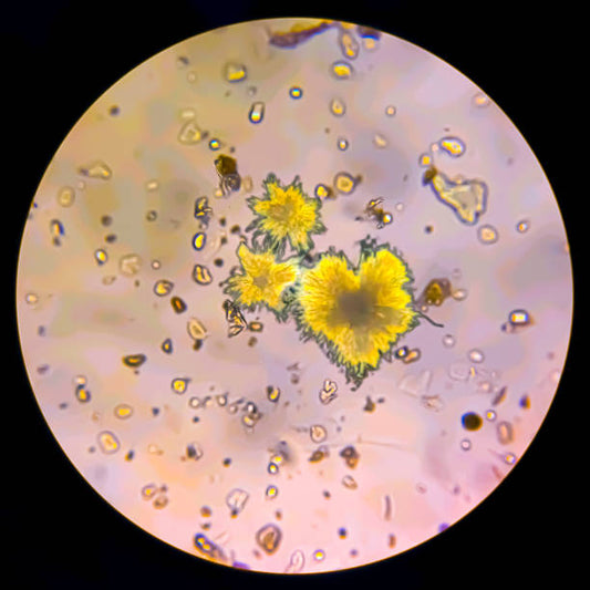 Bilirubin Total