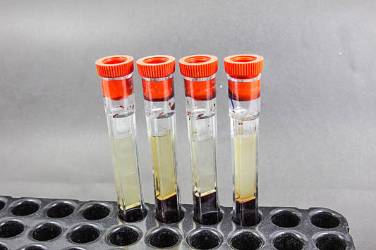 Erythrocyte Sedimentation Rate (ESR)